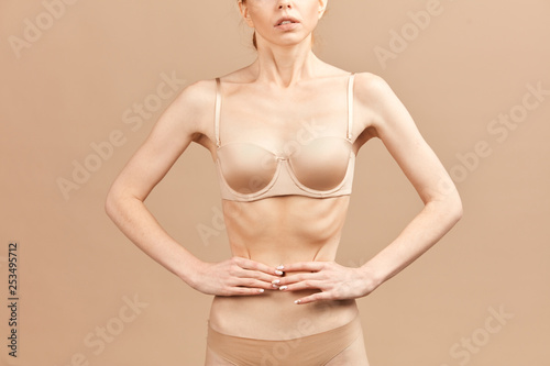 500px x 334px - Unrecognizable skinny anorexic woman posing in nude ...