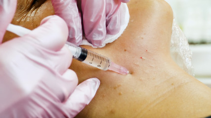 Obraz na płótnie Canvas Cosmetologist making face lifting injection