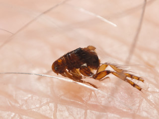 Flea (Siphonaptera) on human skin. Microscopic photo