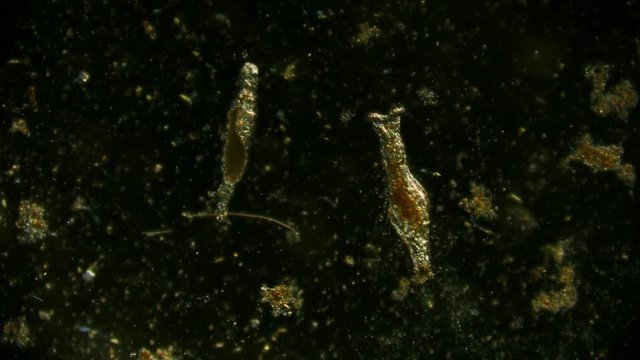 rotifer - protozoa - off-axis illumination of microorganism in pond water under microscope unicellular organism