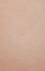 One pimple on human skin