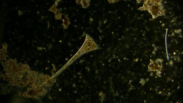 stentor - protozoa - off-axis illumination of microorganism in pond water under microscope unicellular organism