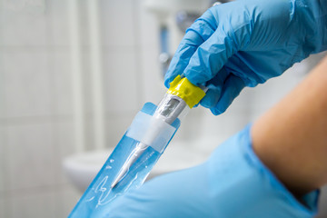 a doctor wearing medical gloves holds a fever thermoter in his hand