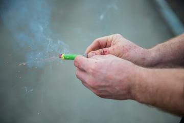 detail of burned injured mans hands after handling fireworks wrong way
