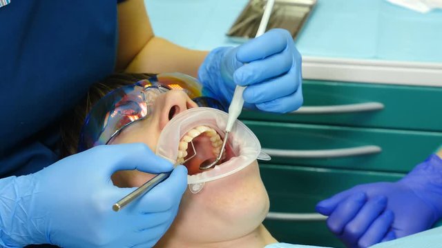 Female doctor treats female patient in her cabinet. Close up shot of young woman with an expander in mouth in dental office. Dentist Using Tools, Vacuum, Drill, Equipment, Instruments in clinic. 4k