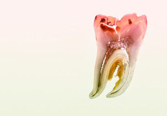 Zahnschnitt im rosa Gegenlicht