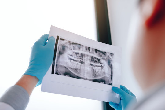 Asian male dentists are analyzing x-ray images of patients at the lab.