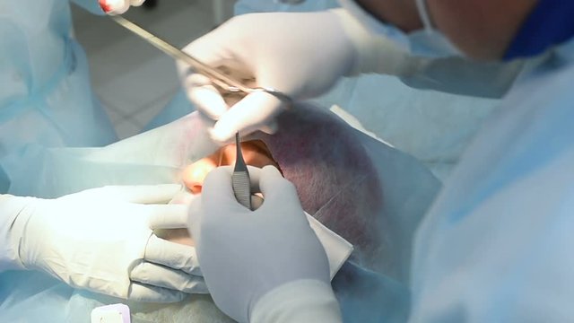 the surgeon dermatologist sutures the wound after surgical removal of a mole or nevus on the face of a woman. Prevention of melanoma