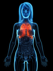 3d rendered medically accurate illustration of a diseased lung