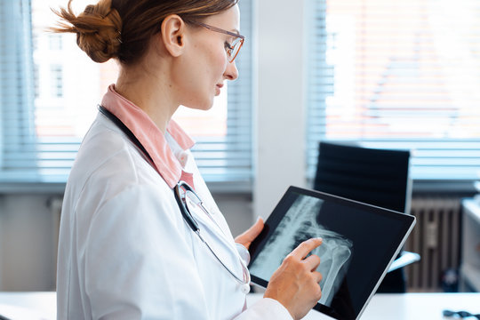 Doctor looking at x-ray picture of a shoulder on her tablet computer