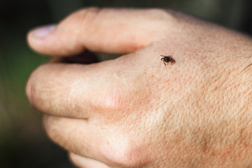 hard-bodied tick of family Ixodidae on skin of human hand