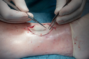 a doctor performs a surgical operation