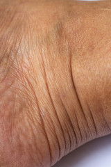 Fototapeta premium Woman's dry skin on ankle, Close up & Macro shot, Asian Body skin part, Healthcare concept, Abstract background