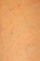 Fototapeta premium Woman's scar skin on leg, Close up & Macro shot, Asian Body skin part, Healthcare concept, Abstract background