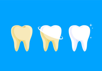 step of whitening tooth. Teeth Whitening. Dental care Concept. Vector illustration isolated on blue background.