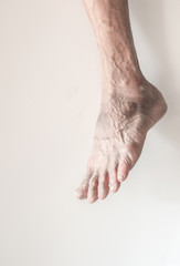 Dry, rugged and worn-out feet of an elderly man on a white backg