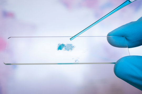 Primer plano de pipeta dejando caer l&iacute;quido azul sobre un portaobjetos