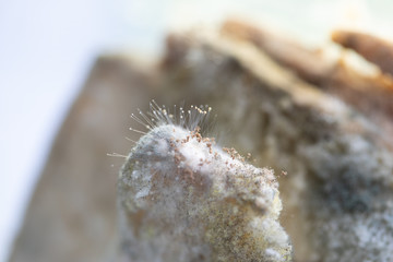 Rhizopus (bread mold) is a genus of common saprophytic fungi,Rhizopus (bread mold) under the microscope.
