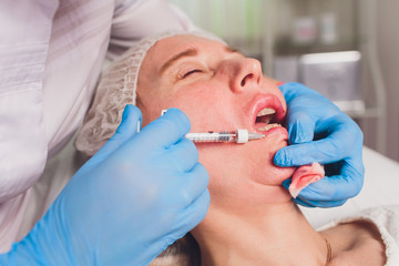 The doctor cosmetologist makes Lip augmentation procedure of a beautiful woman in a beauty...