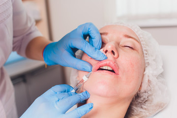 The doctor cosmetologist makes Lip augmentation procedure of a beautiful woman in a beauty...