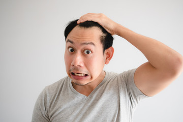 Shocked face of Asian man find himself lost hair and get bald.