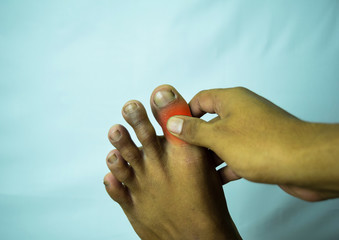 Pain in the joint of big toe can be discouraging