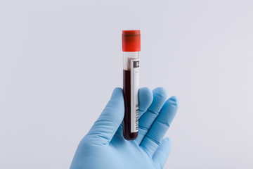 Doctor's hand with medical glove holds an tube with a blood probe