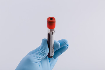 Doctor's hand with medical glove holds an tube with a blood probe