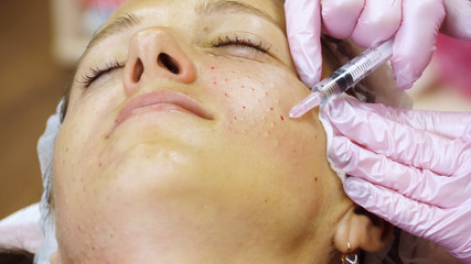 Cosmetician in gloves making face lifting injection