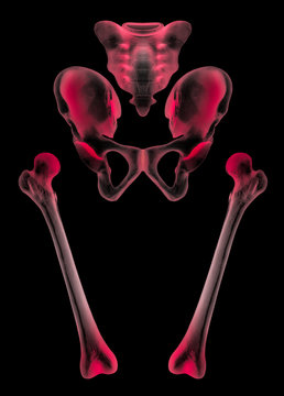 X-ray of separate human hip and femur bone anterior view red highlight in pain area- 3D Medical and Biomedical illustration-Healthcare- Human Anatomy and Medical Concept- Isolated on black background