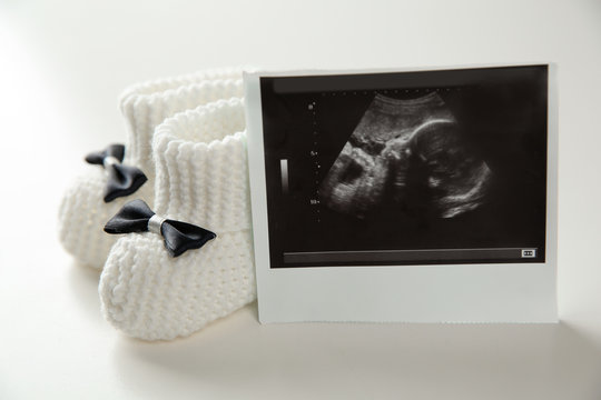 Ultrasound photo of baby and knitted boots on white background