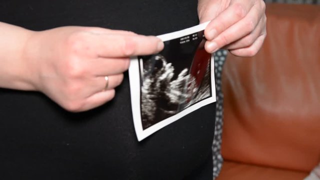female hands holding photo ultrasound on the background of a pregnant belly