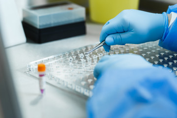 Opening a capsule with potent chemicals with human blood plasma preparations at the DNA Research...
