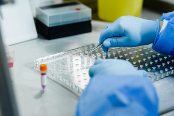 A hand in a protective rubber glove closes the beakers and forms a pool for loading into the...