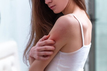 Fototapeta na wymiar Young woman suffering from itching on her skin and scratching an itchy place. Allergic reaction to insect bites, dermatitis, food, drugs. Health care concept. Allergy rash