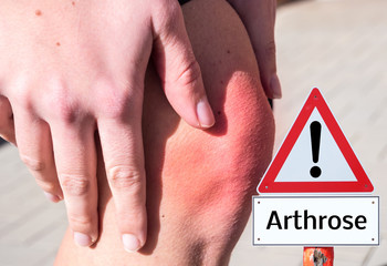Warnschild Arthrose im Knie