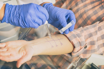 Allergy tests in laboratory