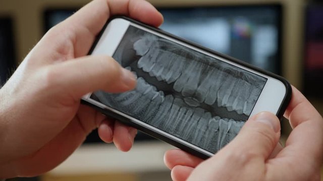 A dentist examines a panoramic teeth x-ray image on a smartphone.  	