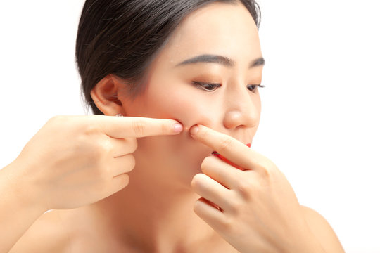 Young asian woman squeeze her acne on face.