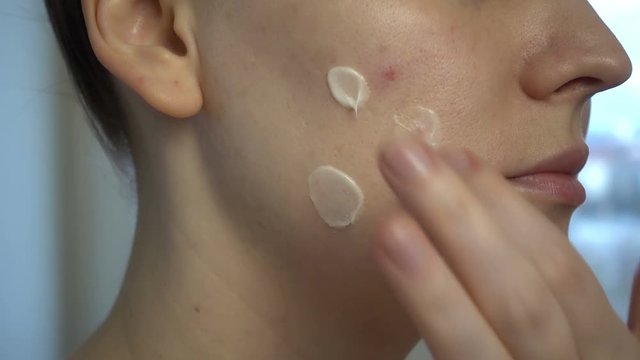 Close up of skin problems (unhealthy skin with acne and pimples). Treatment of problem skin.