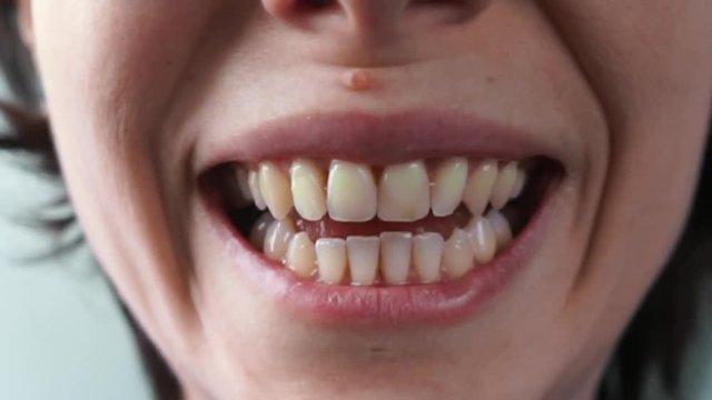 girl's mouth laughing loudly close up