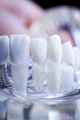 Dentist dental teeth implant