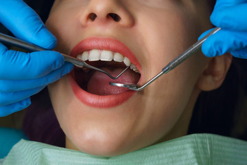 Dentist examines teeth women. Young girl with open mouth. White teeth. Dentist hands with medical instruments. Close-up. Dental clinic.