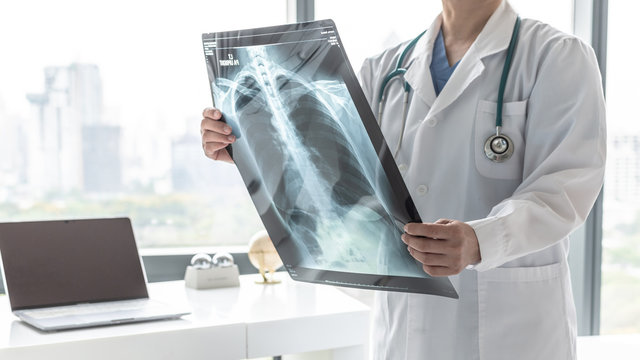 Doctor with radiological chest x-ray film for medical diagnosis on patient’s health on asthma, lung disease and bone cancer illness, healthcare hospital service concept
