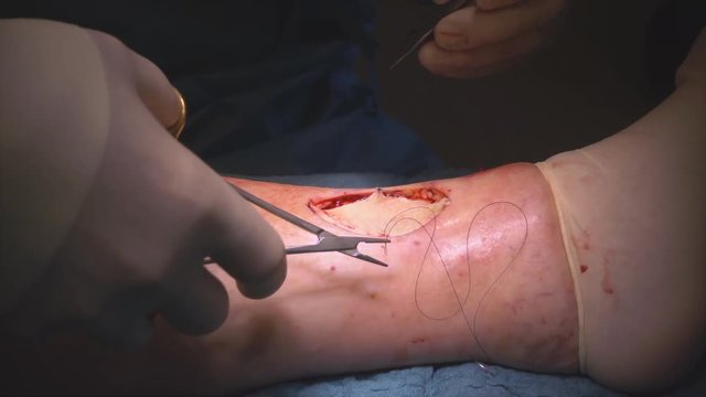 a doctor performs a surgical operation