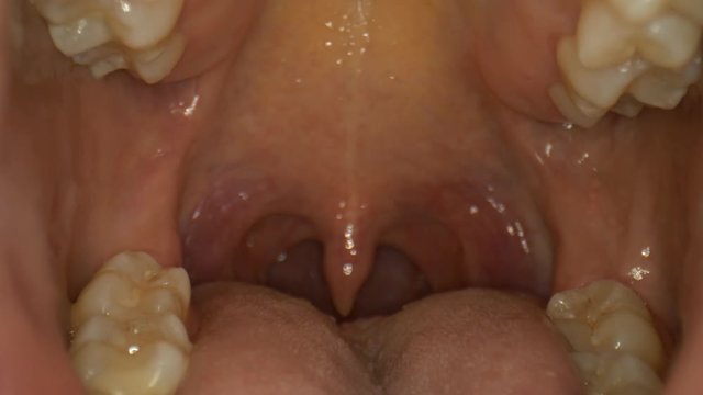 Macro close-up of travelling into a mouth down the throat to the uvula