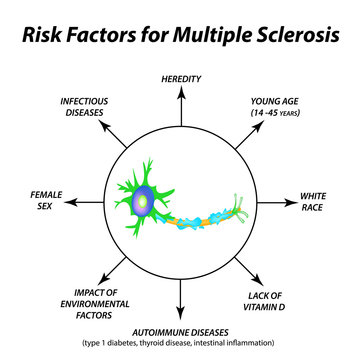 Risk factors for multiple sclerosis. The destruction of the myelin sheath on the axon. Damaged myelin. World Multiple Sclerosis Day. Infographics. Vector illustration on isolated background.