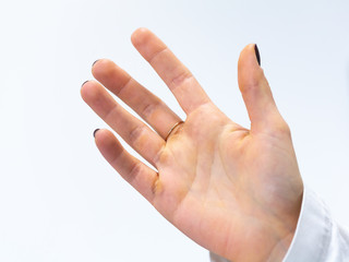 Female hand with calluses