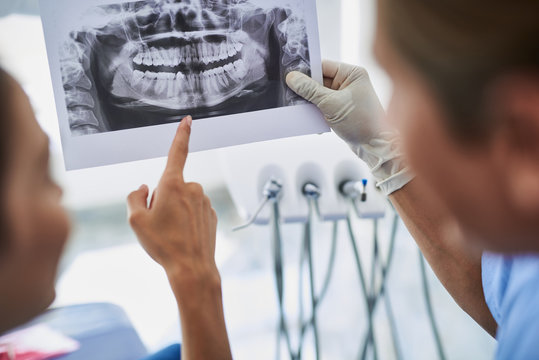 Dentist discussing results of orthopantomogram with young woman