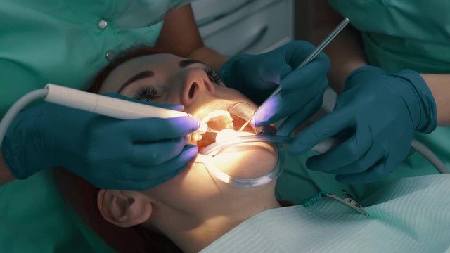 Ultrasonic cleaning of teeth. Removal of solid teeth.